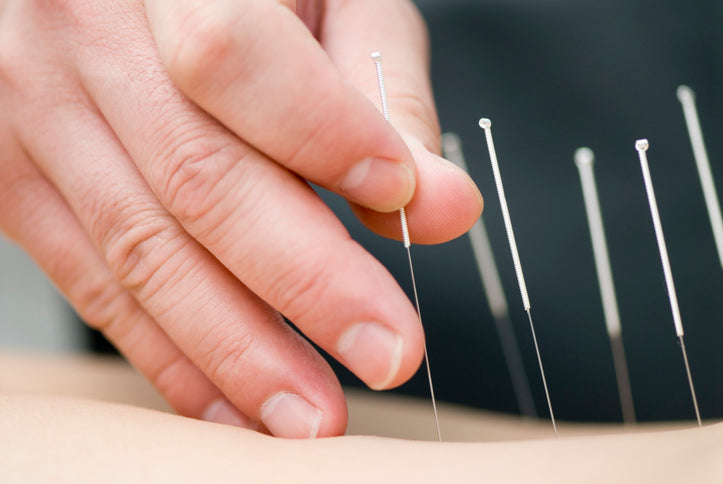 Chinese Medicine - China Acupressure & Acupuncture - PineTales®